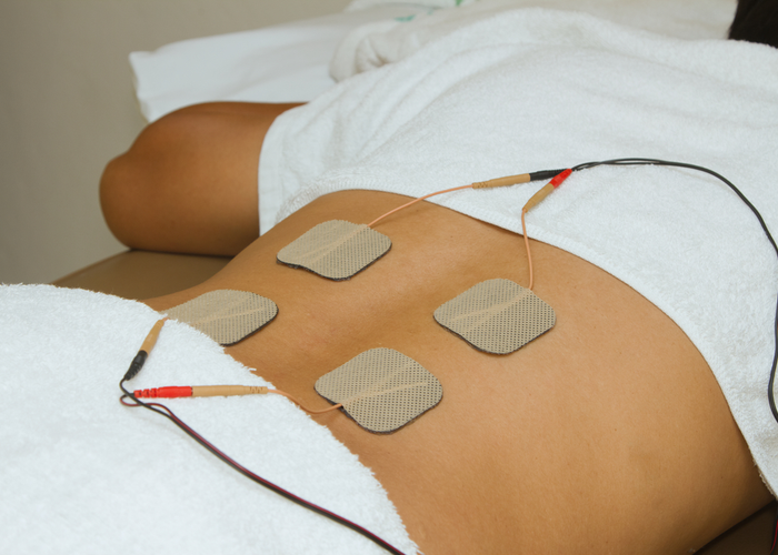Electrode placement for transcutaneous electrical nerve stimulation